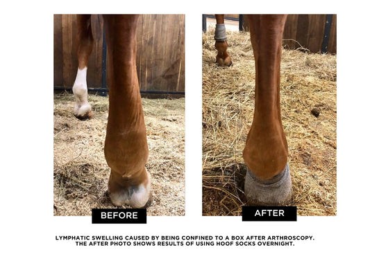 Circulation Exercise Bandages